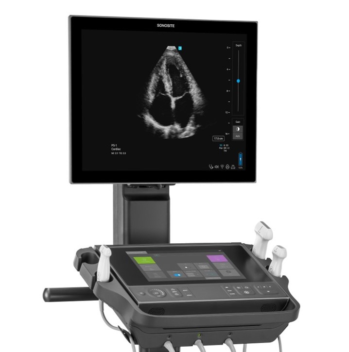 Picture of Sonosite LX