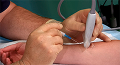 Ultrasound-Guided Peripheral IV Access Video