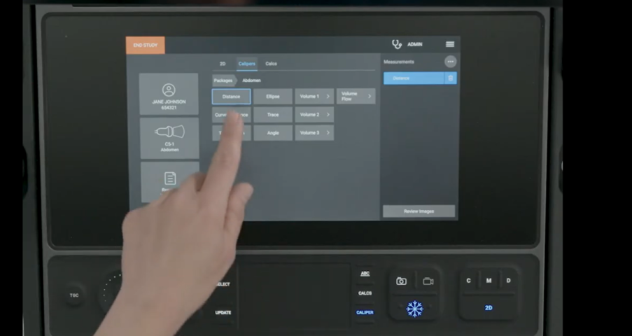 Image of person pointing to correct buttons to press when wanting to take measurements with the Sonosite LX