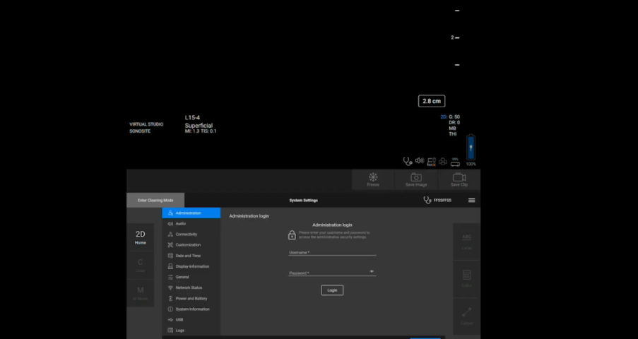 Image on how to change the configuration of Sonosite ST system