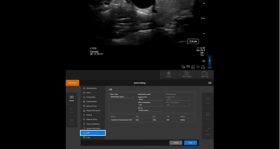 Image of Sonosite ST interface on how to manage your data