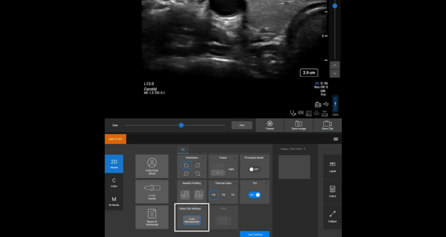 Sonosite ST interface on how to take images and clips on the system